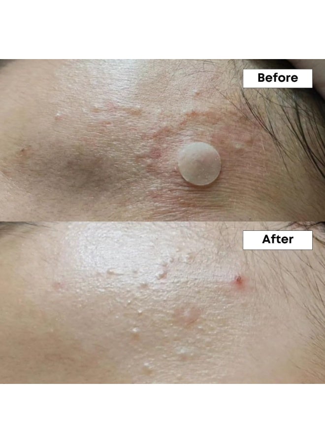 NINELESS A-Control 10% Azelaic Acid Serum - Image 4